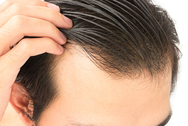 How To Address Hair Loss Caused By Medical Conditions